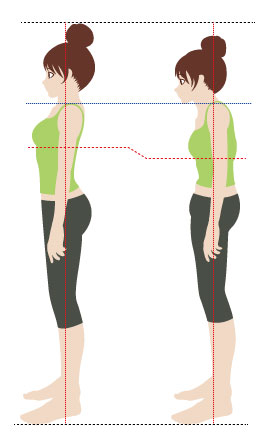 体が不良姿勢を正常だと思い込む